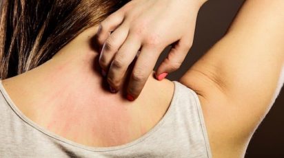 alergia na pele por bijuterias