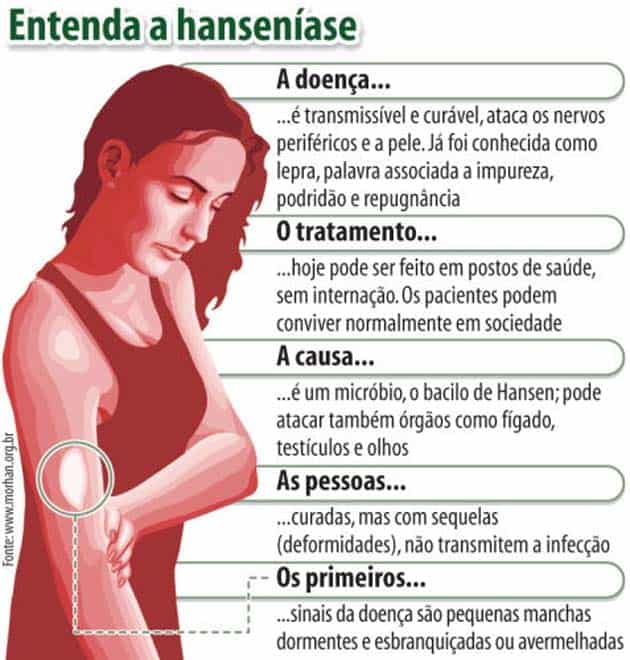 Caracteristicas-da-Hanseniase-6