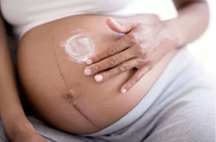 gravidez e alteracoes na pele