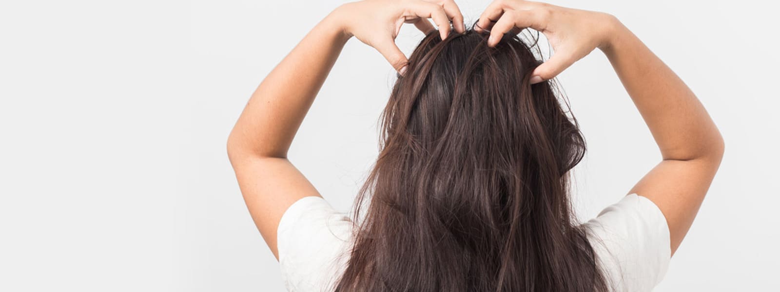 queda de cabelo alopecia em mulher