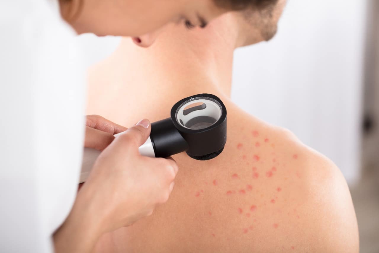 alergia na pele