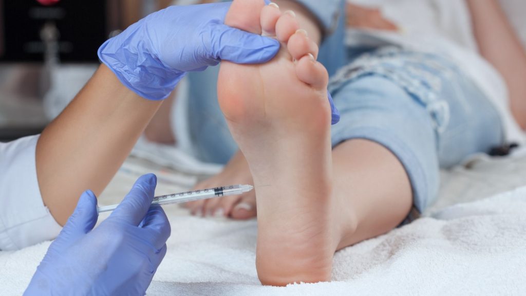 Toxina botulínica para hiperidrose
