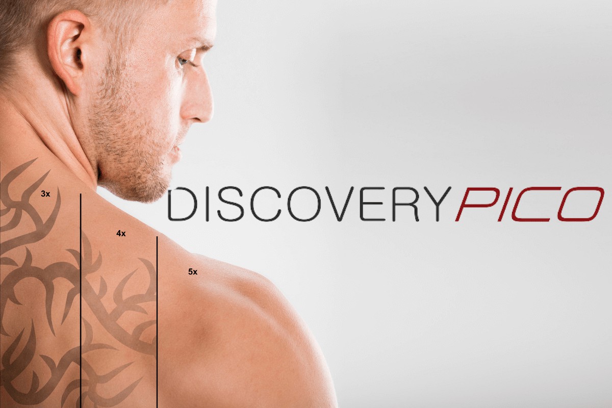 Laser Discovery Pico para remoção de tatuagem
