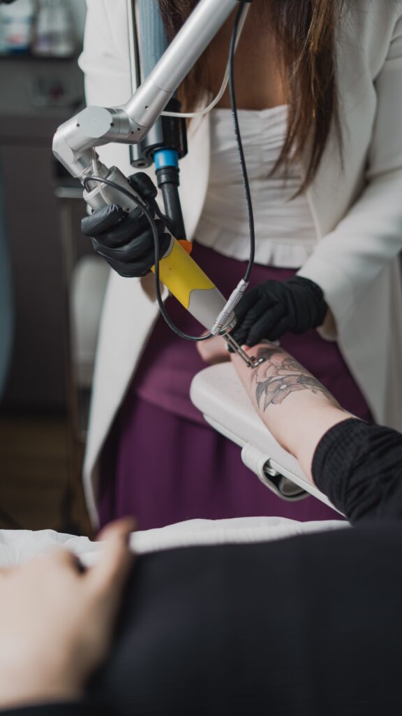 Remoção de tatuagem a laser com Dra. Juliana Toma