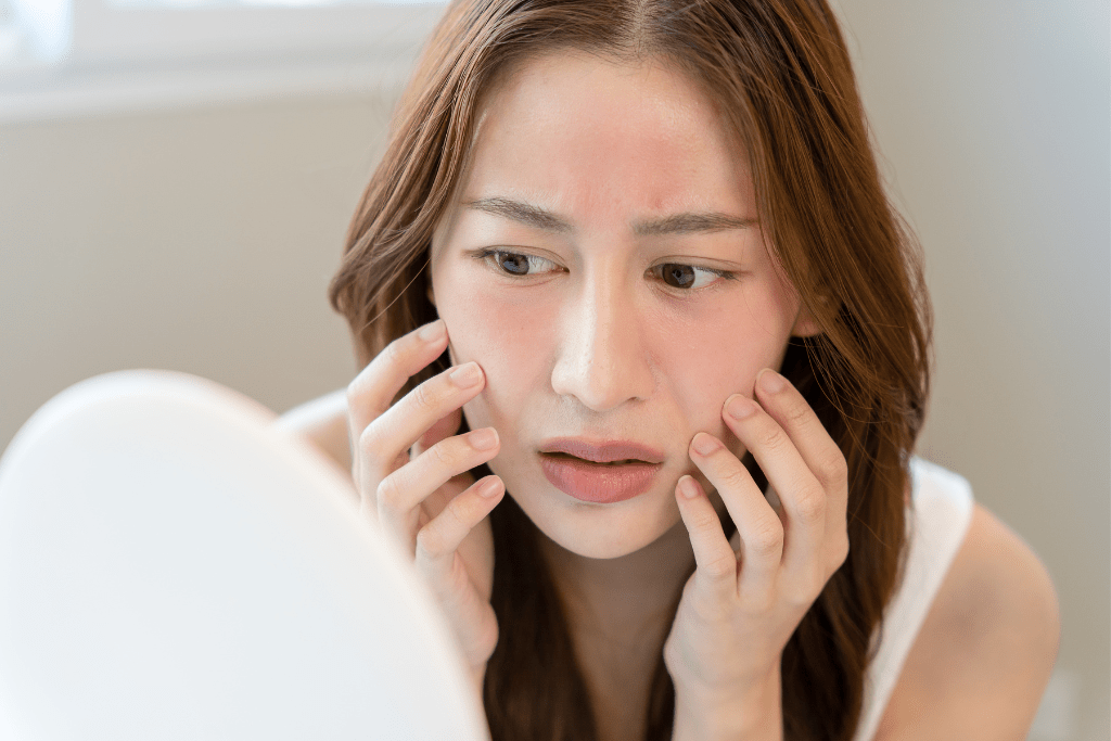O que é, causas e tratamentos da acne vulgar
