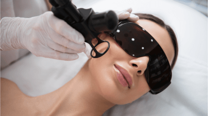Saiba mais sobre o tratamento de laser para acne