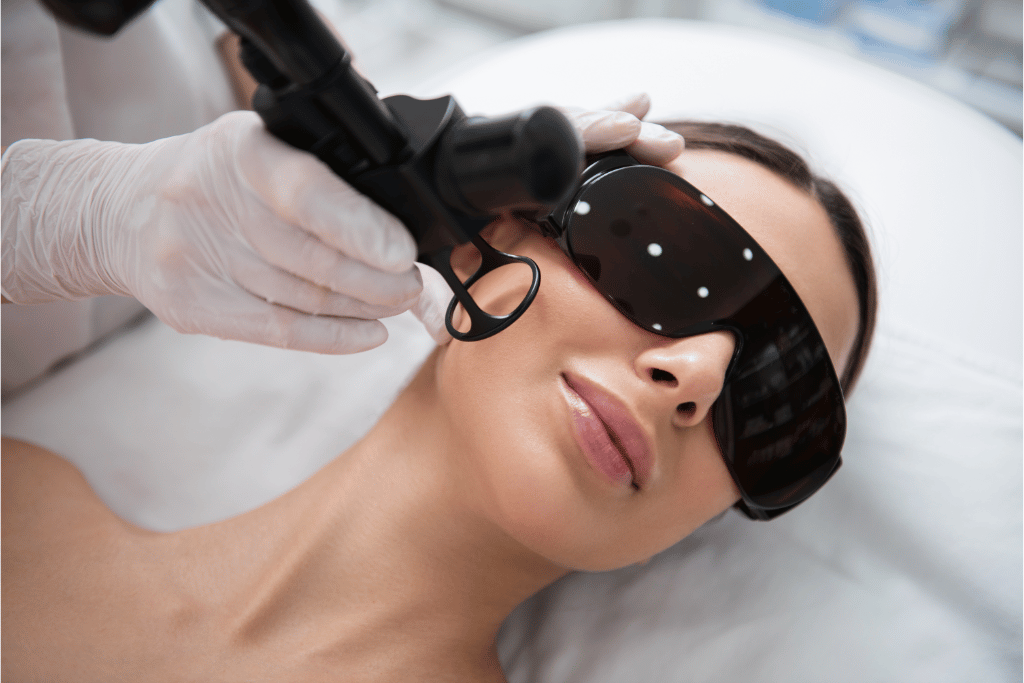 Saiba mais sobre o tratamento de laser para acne