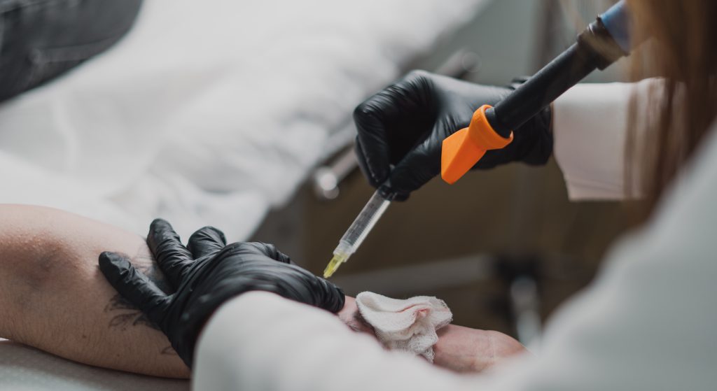 Aplicação de anestesia local antes da sessão de laser em tatuagem