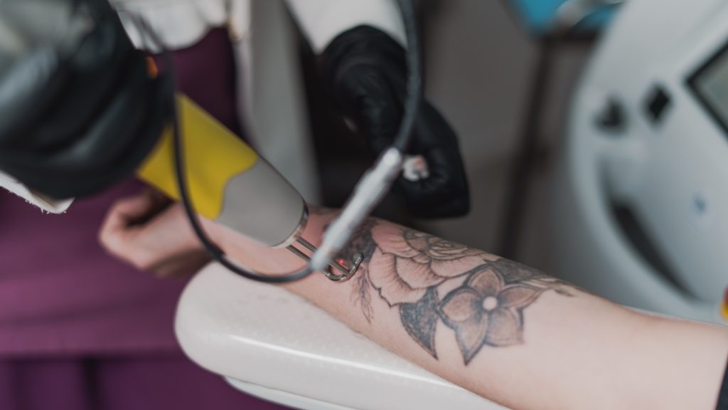Ponteira do laser dispara feixe vermelho sobre tatuagem de rosa